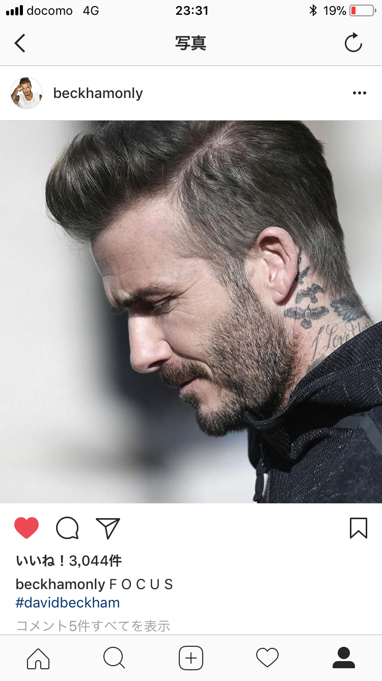 坊主というよりは 植毛 自毛植毛なんでも相談室 植毛ブログ 薄毛の疑問にお答えします