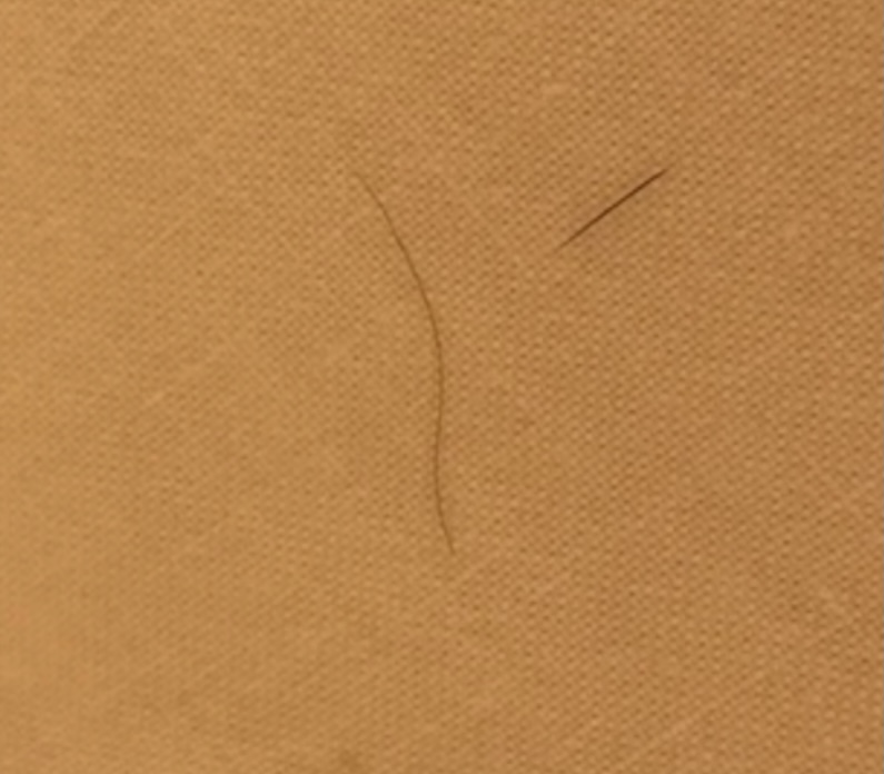 抜け毛について 植毛 自毛植毛なんでも相談室 植毛ブログ 薄毛の疑問にお答えします